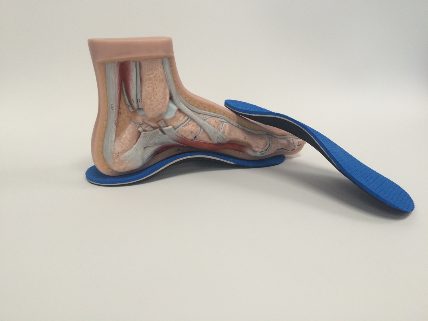Reasons Why One Should Choose Customized Orthotics Over Generalized Ones